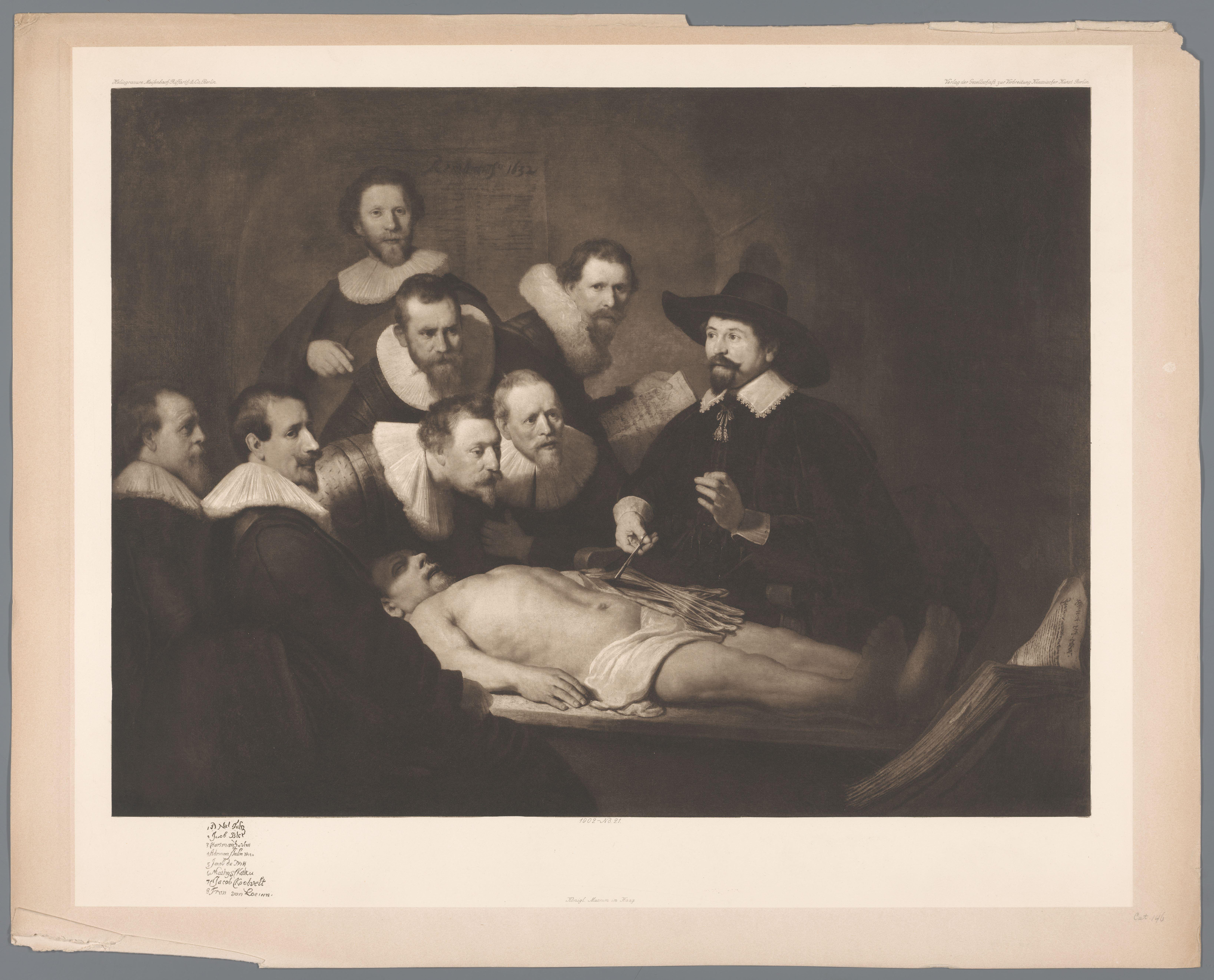 Fotoreproductie van het schilderij De anatomische les van Dr. Nicolaes Tulp door Rembrandt van Rijn