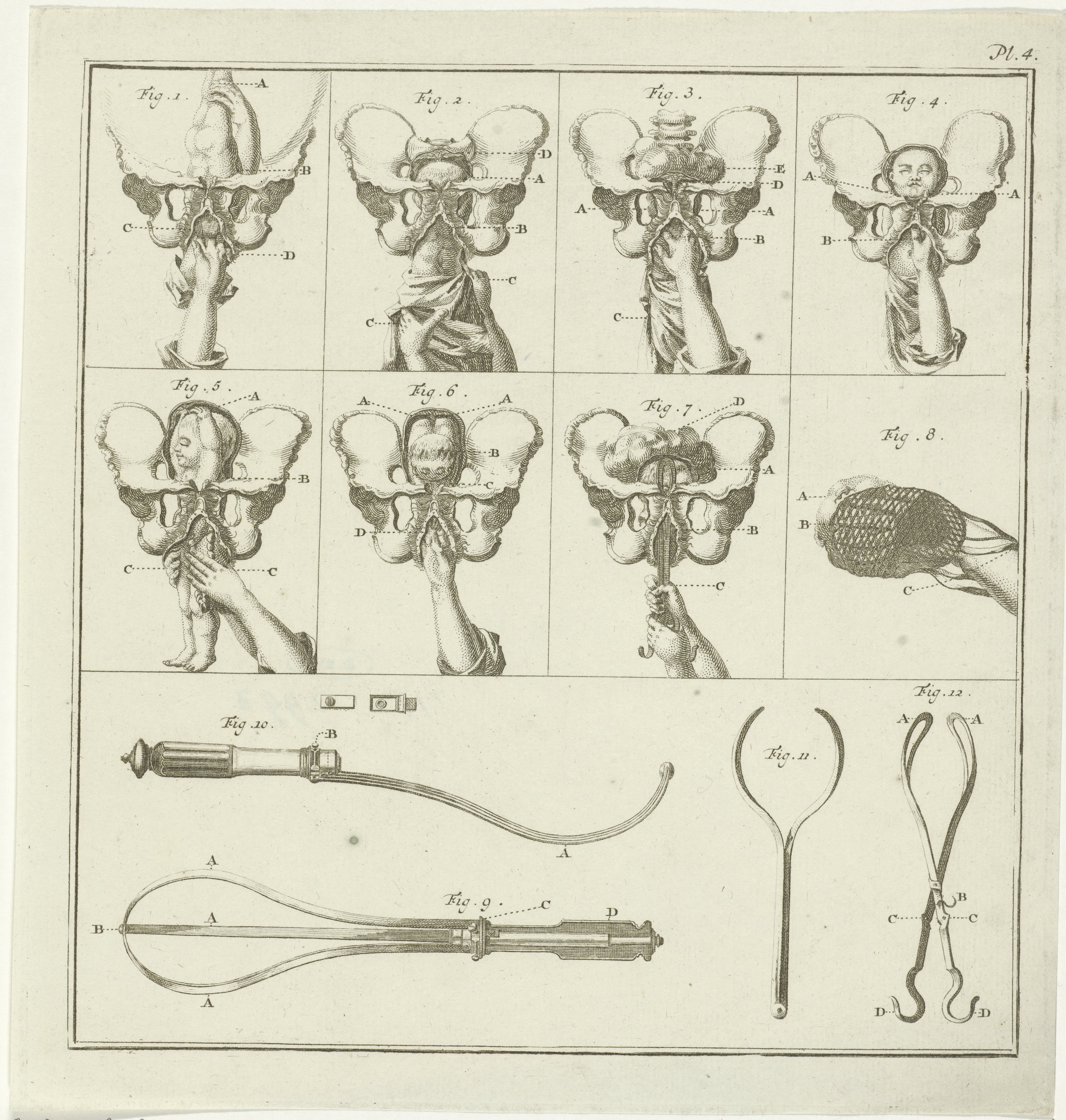 Gynaecologische voorstellingen