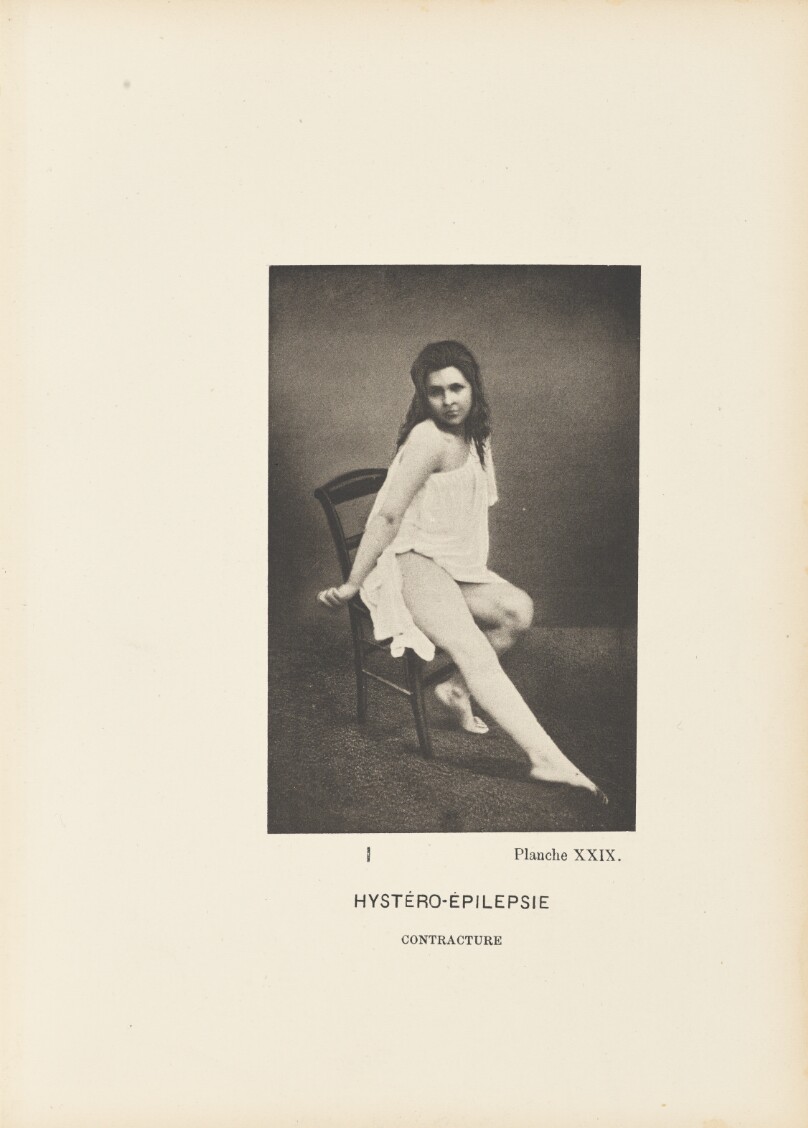 Hystéro-Épilepsie Contracture
