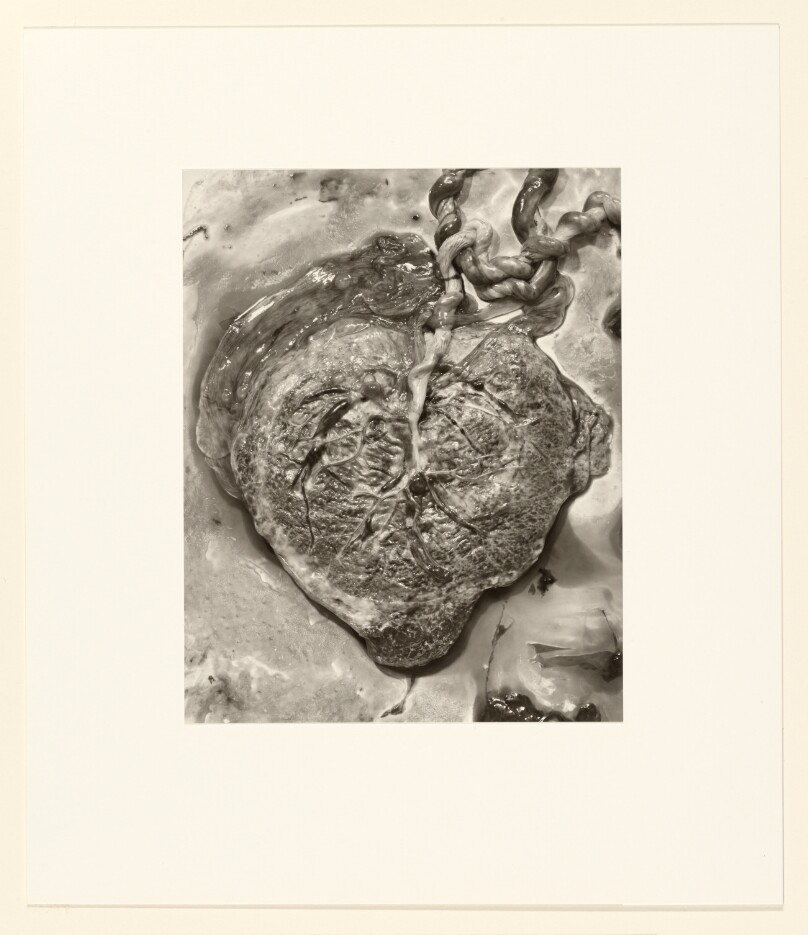 Placenta