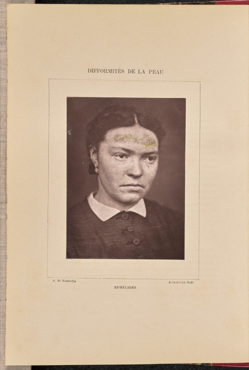 Ephélides