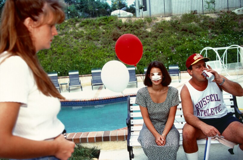 Lindsey at a Fourth of July party three days after her surgery, Calabasas
