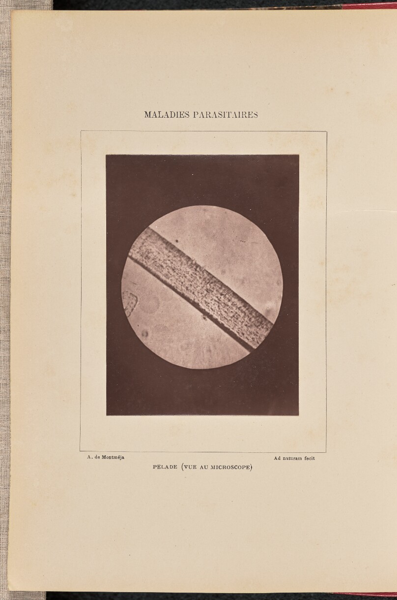 Pelade (vue au microscope)