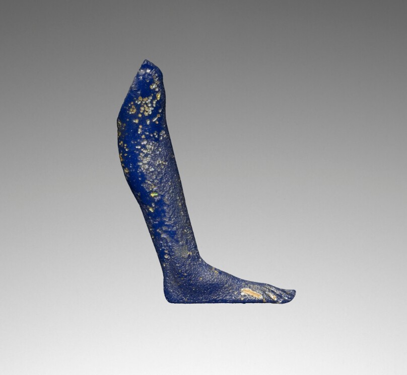 Inlay of a Leg