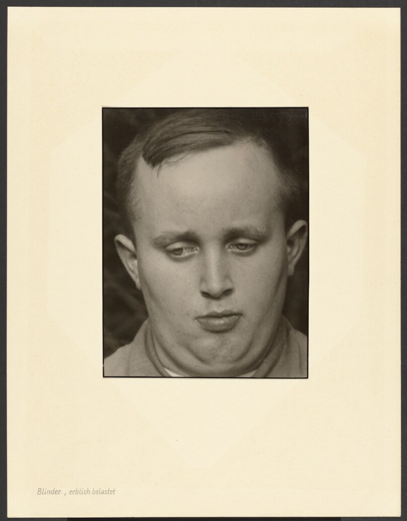 [Blind man, congenitally afflicted (Blinder, erblich belastet)]