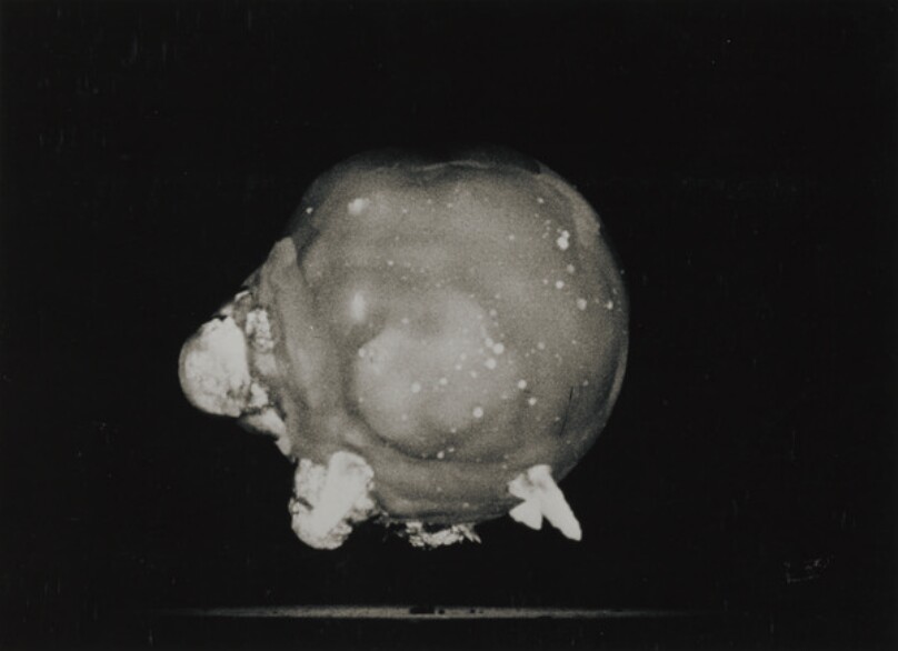 Atomic Bomb Explosion (fireball)