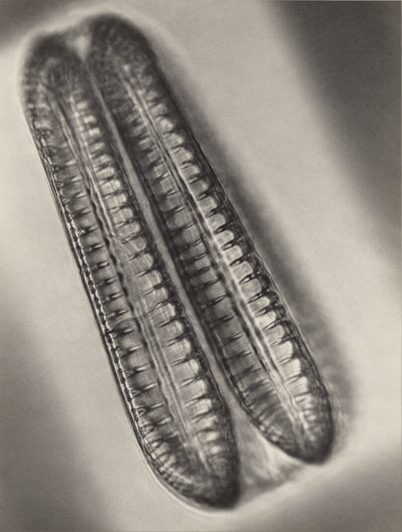 Diatomeen (Surirella elegans) in Teilung