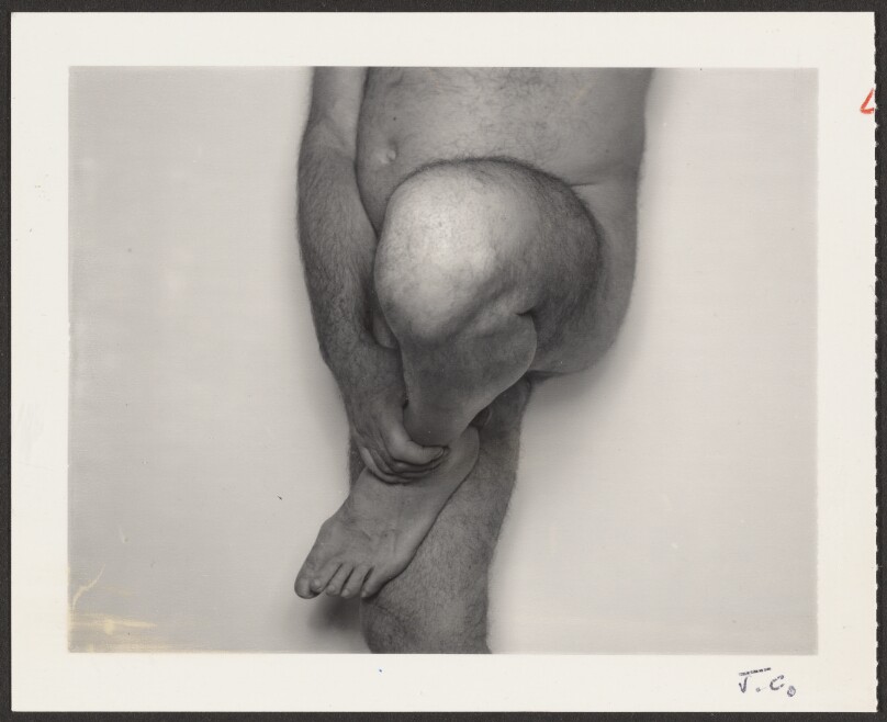 Self-Portrait with Knee Up, Variation 4