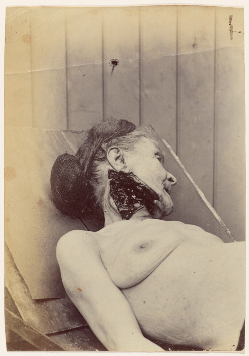 Baronne Dellard (Victime d’Anastay)