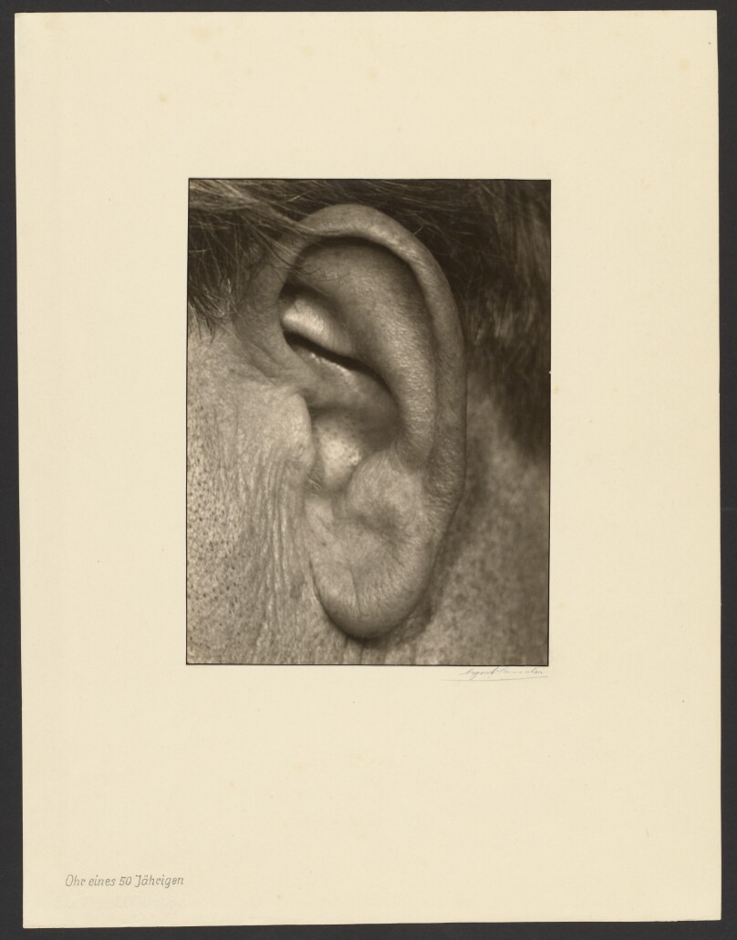 [Ear of a 50 year old man (Ohr eines 50-Jährigen)]