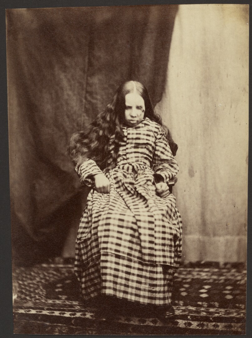 [Portrait of a Female Patient, Surrey County Asylum]