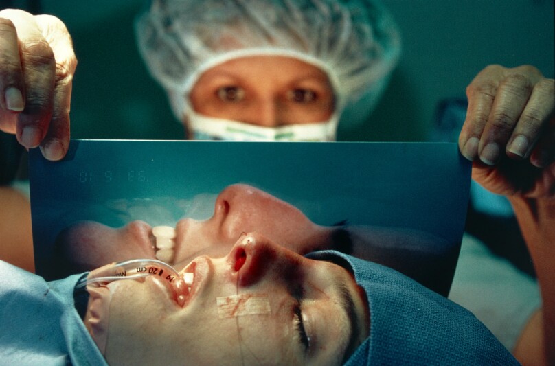Lindsey, 18, after her nose-job surgery, a nurse holds a photograph of Lindsey's pre-operation nose, West Hollywood