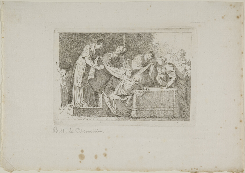 Circumcision