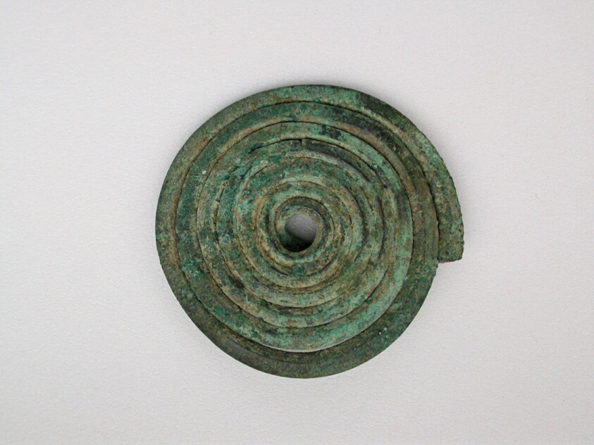 Spiral Fibula